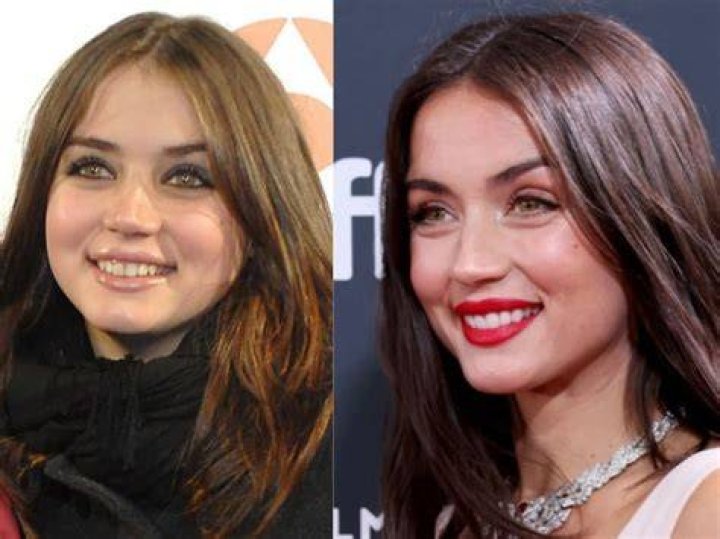 Ana de Armas Before and After Plastic Surgery Nose, Boob