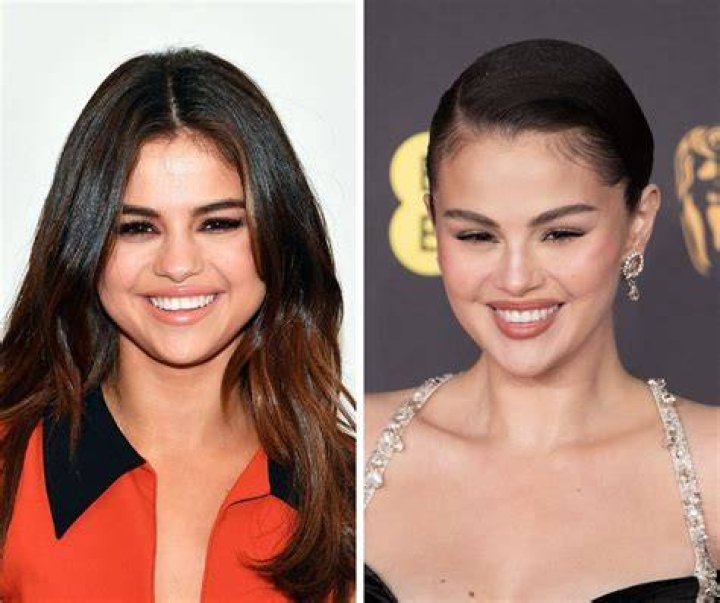Did Selena Gomez Ever Get Plastic Surgery? Why She Has Sparked Rumors
