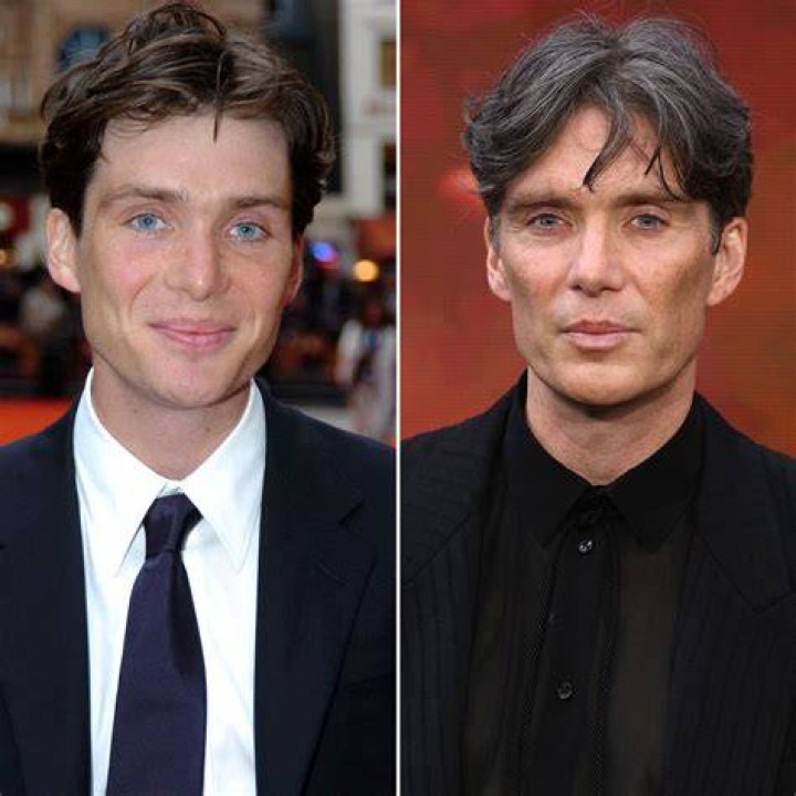 Has Cillian Murphy Had Plastic Surgery? See &lsquo;Oppenheimer&rsquo; Star&rsquo;s