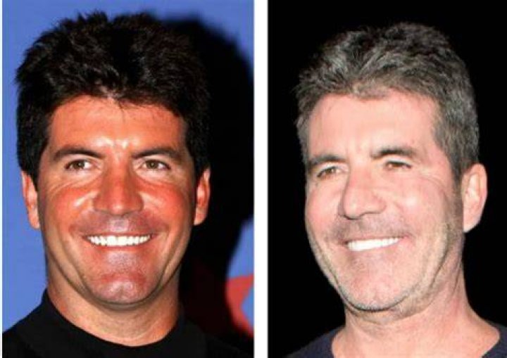 Understanding Simon Cowell's Illness: A Journey Through Challenges