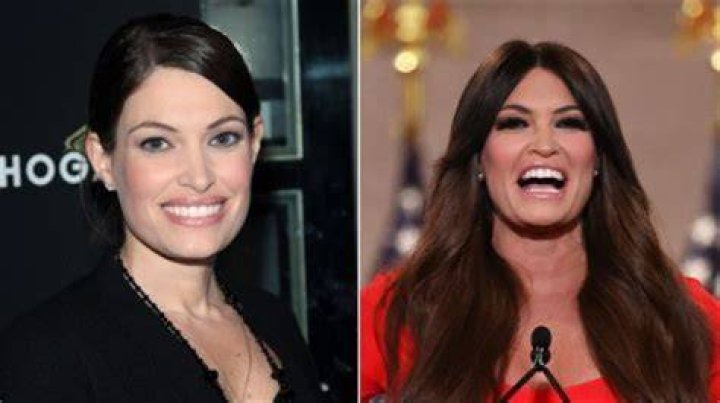 Unveiling The Transformations: Kimberly Guilfoyle's Plastic Surgeries