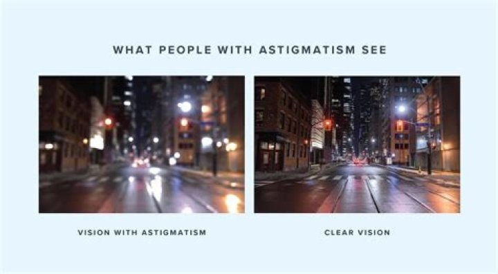 What Is Astigmatism & Everything You Need to Know — UNIQSO