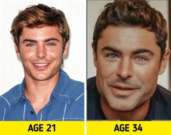 Zac Efron Before and After Has He Had Any Plastic Surgery? Zac efron